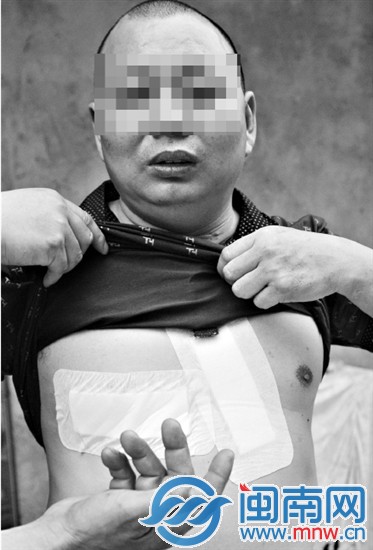 王先生的胸口被連刺了三刀，脖子上的刀傷已留下明顯